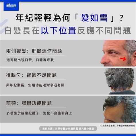 左手 長白毛|突然長白髮有3大隱患，尤其這些位置是身體在求救